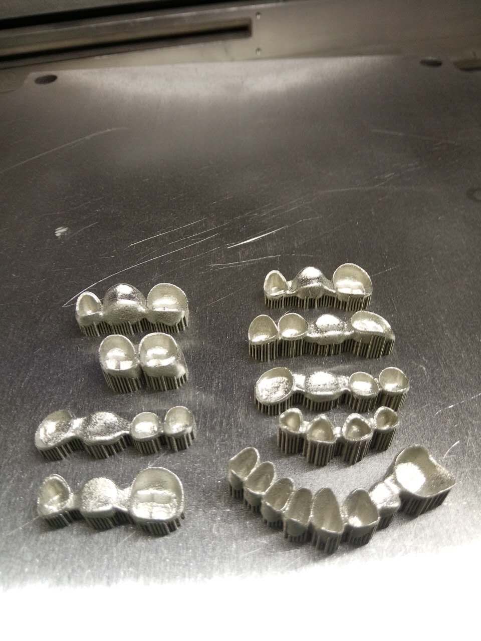金属3D打印牙冠